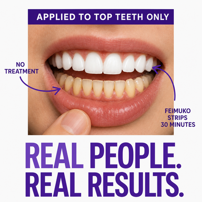 Feimuko Purple Teeth Whitening Strips